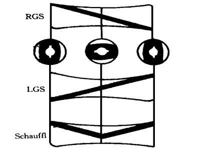 Figure 1 Rotor-Style Large Lead Screw Element